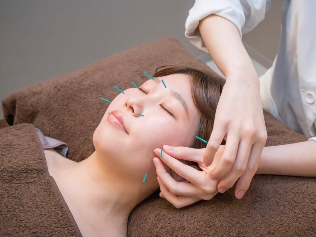 美容鍼灸でPMS対策を！