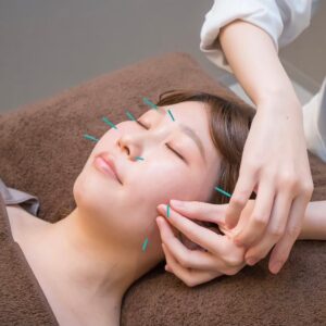 美容鍼灸でPMS対策を！