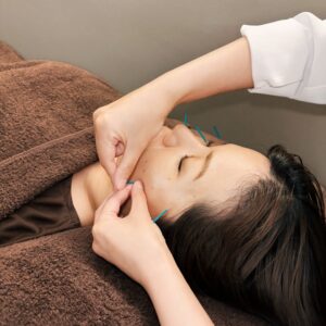 美容鍼灸で自律神経を整える