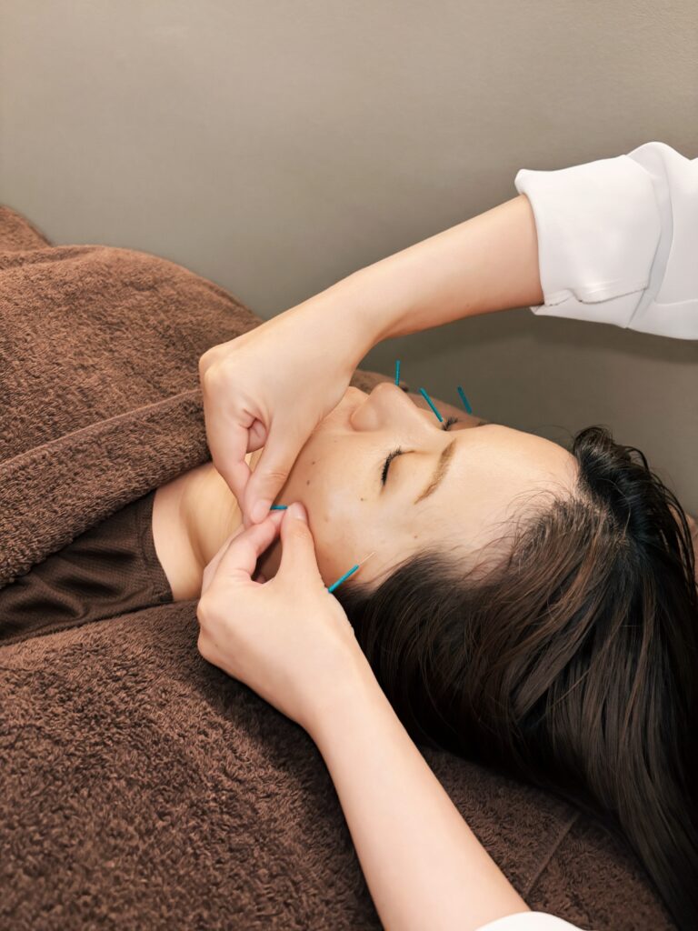 美容鍼灸で自律神経を整える